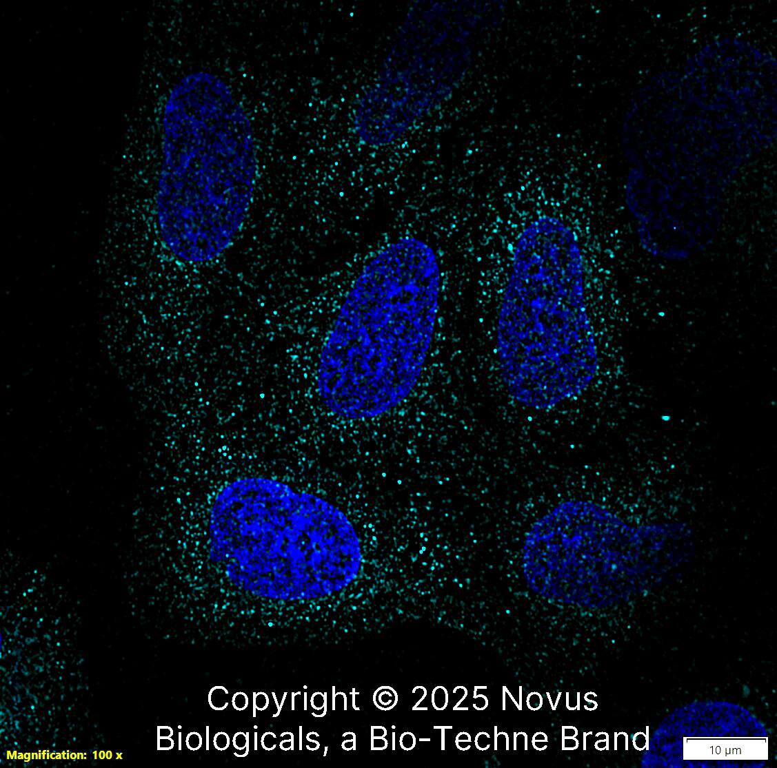 Aquaporin-5 was detected in immersion fixed U-2 OS human osteosarcoma cell line using Rabbit anti-Aquaporin-5 Antigen Affinity-purified Polyclonal Antibody conjugated to Alexa Fluor® 647 (Catalog # NBP2-67247AF647) (light blue) at 10 µg/mL overnight at 4C.  Cells were counterstained with DAPI (blue). Cells were imaged using a 100X objective and digitally deconvolved.