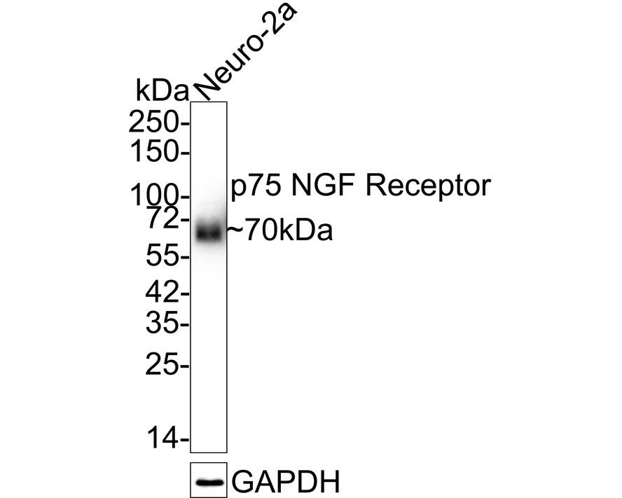 Western blot analysis of  Neuro-2a cell lysates with NBP2-67296 at 1/2,000 dilution. Lysates/proteins at 15 µg/Lane. Predicted band size: 45 kDa Observed band size: 70 kDa Exposure time: 3 minutes; 4-20% SDS-PAGE gel. Proteins were transferred to a PVDF membrane and blocked with 5% NFDM/TBST for 1 hour at room temperature. NBP2-67296 at 1/2,000 dilution was used in 5% NFDM/TBST at 4℃ overnight. Goat Anti-Rabbit IgG [HRP] Secondary Antibody at 1:50,000 dilution was used for 1 hour at room temperature.