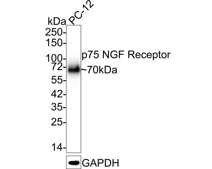 Western blot analysis of  PC-12 cell lysates with NBP2-67296 at 1/5,000 dilution. Lysates/proteins at 15 µg/Lane. Predicted band size: 45 kDa Observed band size: 70 kDa Exposure time: 1 minute; 4-20% SDS-PAGE gel. Proteins were transferred to a PVDF membrane and blocked with 5% NFDM/TBST for 1 hour at room temperature. NBP2-67296 at 1/5,000 dilution was used in 5% NFDM/TBST at 4℃ overnight. Goat Anti-Rabbit IgG [HRP] Secondary Antibody at 1:50,000 dilution was used for 1 hour at room temperature.