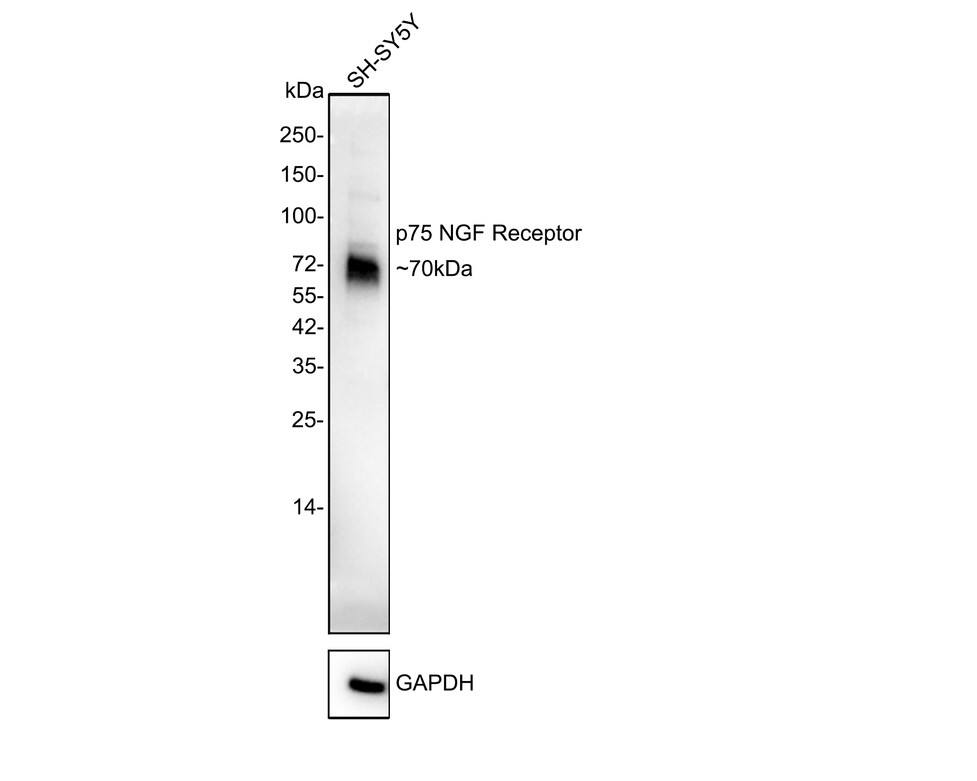 Western blot analysis of  SH-SY5Y cell lysates with NBP2-67296 at 1/2,000 dilution. Lysates/proteins at 20µg/Lane. Predicted band size: 45 kDa Observed band size: 70 kDa Exposure time: 1 minutes 59 seconds; 4-20% SDS-PAGE gel. Proteins were transferred to a PVDF membrane and blocked with 5% NFDM/TBST for 1 hour at room temperature. NBP2-67296 at 1/2,000 dilution was used in 5% NFDM/TBST at 4℃ overnight. Goat Anti-Rabbit IgG [HRP] Secondary Antibody at 1:50,000 dilution was used for 1 hour at room temperature.