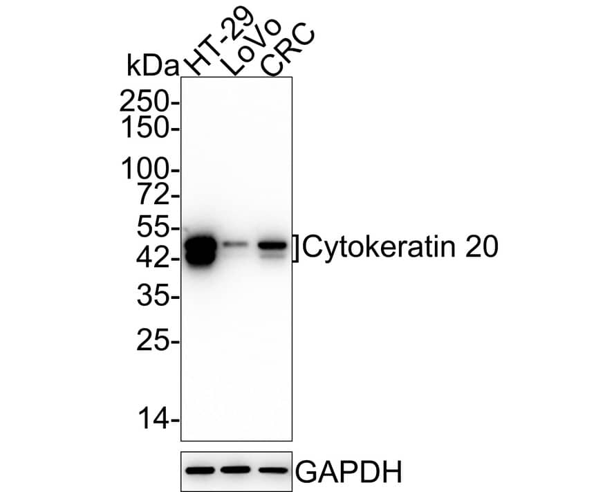 Western Blot Cytokeratin 20 Antibody (SA35-03)