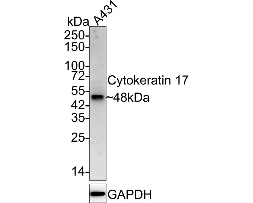 Western blot analysis of  A431 cell lysates with NBP2-67318 at 1/2,000 dilution. Lysates/proteins at 15 µg/Lane. Predicted band size: 48 kDa Observed band size: 48 kDa Exposure time: 3 minutes; 4-20% SDS-PAGE gel. Proteins were transferred to a PVDF membrane and blocked with 5% NFDM/TBST for 1 hour at room temperature. NBP2-67318 at 1/2,000 dilution was used in 5% NFDM/TBST at 4℃ overnight. Goat Anti-Rabbit IgG [HRP] Secondary Antibody at 1/50,000 dilution was used for 1 hour at room temperature.
