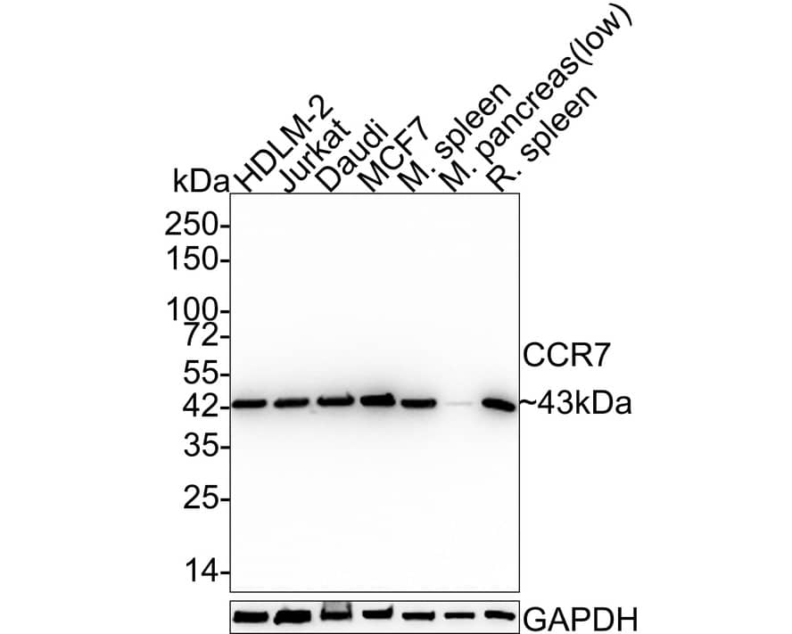Western blot analysis on different lysates with NBP2-67324 at 1/5,000 dilution. Lane 1: HDLM-2 cell lysate Lane 2: Jurkat cell lysate Lane 3: Daudi cell lysate Lane 4: MCF7 cell lysate Lane 5: Mouse spleen tissue lysate Lane 6: Mouse pancreas tissue lysate (low expression) Lane 7: Rat spleen tissue lysate Lysates/proteins at 20 µg/Lane. Predicted band size: 43 kDa Observed band size: 43 kDa Exposure time: 24 seconds; 4-20% SDS-PAGE gel. Proteins were transferred to a PVDF membrane and blocked with 5% NFDM/TBST for 1 hour at room temperature. NBP2-67324 at 1/5,000 dilution was used in 5% NFDM/TBST at 4℃ overnight. Goat Anti-Rabbit IgG [HRP] Secondary Antibody at 1:50,000 dilution was used for 1 hour at room temperature.