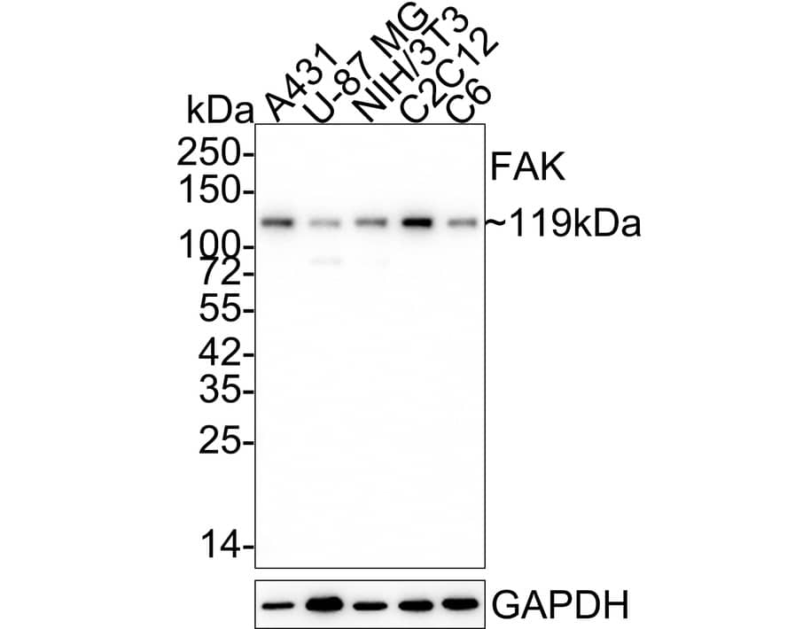 Western blot analysis on different lysates with NBP2-67327 at 1/5,000 dilution. Lane 1: A431 cell lysate (15 µg/Lane) Lane 2: U-87 MG cell lysate (15 µg/Lane) Lane 3: NIH/3T3 cell lysate (15 µg/Lane) Lane 4: C2C12 cell lysate (15 µg/Lane) Lane 5: C6 cell lysate (15 µg/Lane) Predicted band size: 119 kDa Observed band size: 119 kDa Exposure time: 3 minutes; 4-20% SDS-PAGE gel. Proteins were transferred to a PVDF membrane and blocked with 5% NFDM/TBST for 1 hour at room temperature. NBP2-67327 at 1/5,000 dilution was used in 5% NFDM/TBST at 4℃ overnight. Goat Anti-Rabbit IgG [HRP] Secondary Antibody at 1:50,000 dilution was used for 1 hour at room temperature.