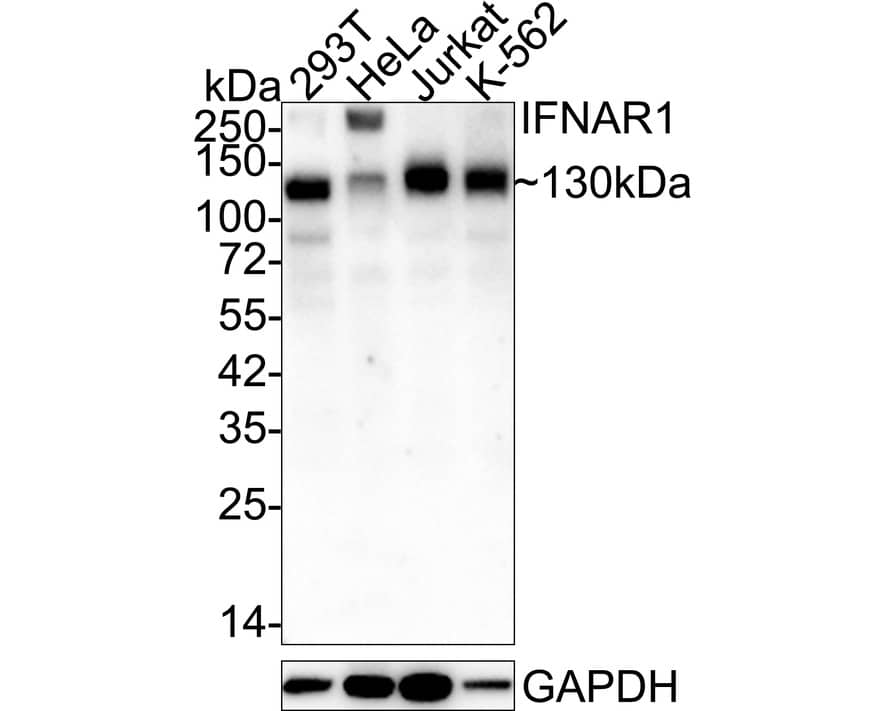Western Blot IFN-alpha/beta R1 Antibody (SR45-08)