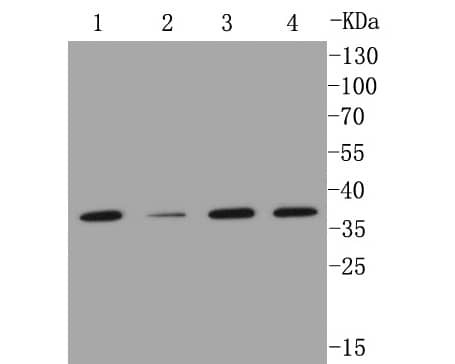 Western blot analysis on different lysates. Proteins were transferred to a PVDF membrane and blocked with NBP2-67344 at room temperature. The primary antibody (NBP2-67344, 1/500) was used in 5% BSA at room temperature for 2 hours. Goat Anti-Rabbit IgG [HRP] Secondary Antibody at 1:5,000 dilution was used for 1 hour at room temperature. Positive control: Lane 1: A549 cell lysate Lane 2: Hela cell lysate Lane 3: MCF-7 cell lysate Lane 4: THP-1 cell lysate
