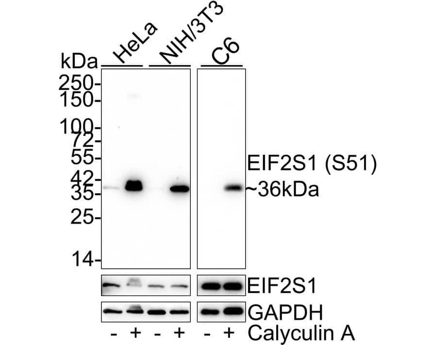 Western blot analysis on different lysates with NBP2-67353 at 1/2,000 dilution. Lane 1: HeLa whole cell lysate (15 µg/Lane) Lane 2: HeLa treated with 50nM Calyculin A for 3 hours whole cell lysate (15 µg/Lane) Lane 3: NIH/3T3 whole cell lysate (15 µg/Lane) Lane 4: NIH/3T3 treated with 100nM Calyculin A for 30 minutes whole cell lysate (15 µg/Lane) Lane 5: C6 whole cell lysate (20 µg/Lane) Lane 6: C6 treated with 100nM Calyculin A for 30 minutes whole cell lysate (20 µg/Lane) Predicted band size: 36 kDa Observed band size: 36 kDa Exposure time: Lane 1-4: 2 minutes; Lane 5-6: 23 seconds； 4-20% SDS-PAGE gel. Proteins were transferred to a PVDF membrane and blocked with 5% NFDM/TBST for 1 hour at room temperature. NBP2-67353 at 1/2,000 dilution was used in 5% NFDM/TBST at 4℃ overnight. Goat Anti-Rabbit IgG [HRP] Secondary Antibody at 1:50,000 dilution was used for 1 hour at room temperature.