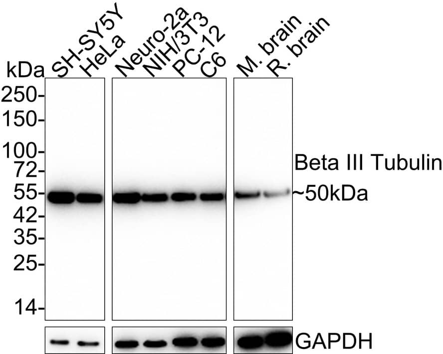 Western blot analysis on different lysates with NBP2-67374 at 1/20,000 dilution. Lane 1: SH-SY5Y cell lysate (15 µg/Lane) Lane 2: HeLa cell lysate (15 µg/Lane) Lane 3: Neuro-2a cell lysate (15 µg/Lane) Lane 4: NIH/3T3 cell lysate (15 µg/Lane) Lane 5: PC-12 cell lysate (15 µg/Lane) Lane 6: C6 cell lysate (15 µg/Lane) Lane 7: Mouse brain tissue lysate (20 µg/Lane) Lane 8: Rat brain tissue lysate (20 µg/Lane) Predicted band size: 50 kDa Observed band size: 50 kDa Exposure time: 3 minutes 54 seconds; 4-20% SDS-PAGE gel. Proteins were transferred to a PVDF membrane and blocked with 5% NFDM/TBST for 1 hour at room temperature. NBP2-67374 at 1/20,000 dilution was used in 5% NFDM/TBST at room temperature for 2 hours. Goat Anti-Rabbit IgG [HRP] Secondary Antibody at 1:50,000 dilution was used for 1 hour at room temperature.