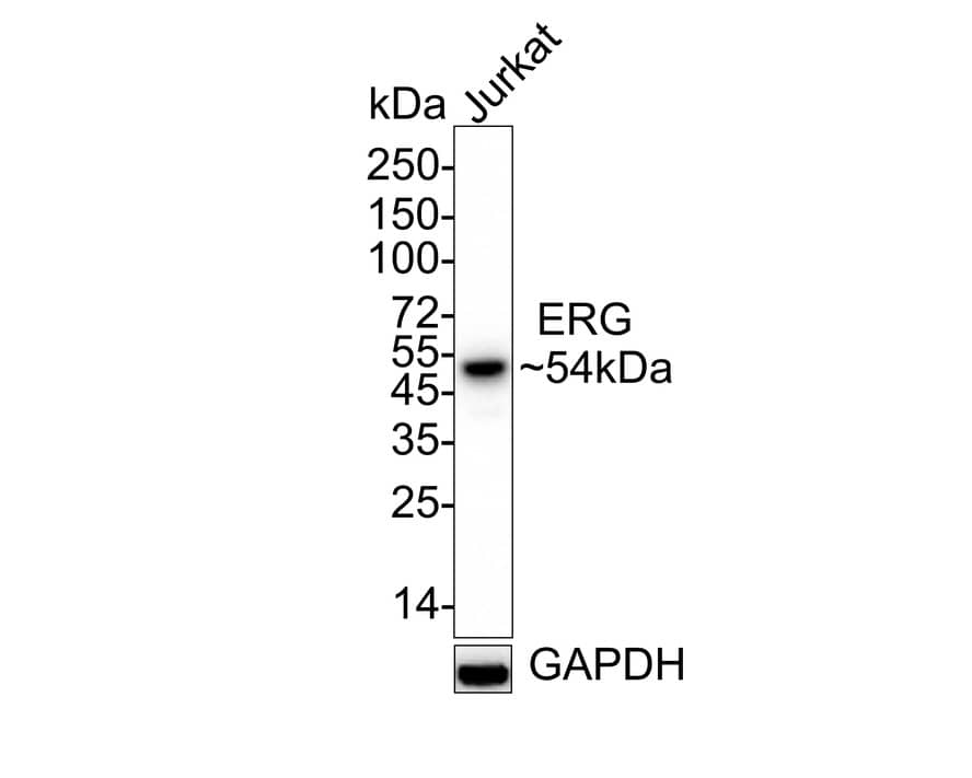 Western blot analysis of  Jurkat cell lysates with NBP2-67375 at 1/2,000 dilution. Lysates/proteins at 20 µg/Lane. Predicted band size: 54 kDa Observed band size: 54 kDa Exposure time: 20 seconds; 4-20% SDS-PAGE gel. Proteins were transferred to a PVDF membrane and blocked with 5% NFDM/TBST for 1 hour at room temperature. NBP2-67375 at 1/2,000 dilution was used in 5% NFDM/TBST at 4℃ overnight. Goat Anti-Rabbit IgG [HRP] Secondary Antibody at 1/50,000 dilution was used for 1 hour at room temperature.