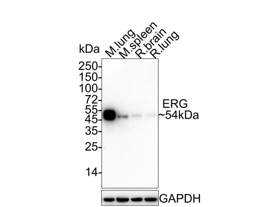 Western blot analysis on different lysates with NBP2-67375 at 1/2,000 dilution. Lane 1: Mouse lung tissue lysate Lane 2: Mouse spleen tissue lysate Lane 3: Rat brain tissue lysate Lane 4: Rat lung tissue lysate Lysates/proteins at 20 µg/Lane. Predicted band size: 54 kDa Observed band size: 54 kDa Exposure time: 1 minutes 2 seconds; 4-20% SDS-PAGE gel. Proteins were transferred to a PVDF membrane and blocked with 5% NFDM/TBST for 1 hour at room temperature. NBP2-67375 at 1/2,000 dilution was used in 5% NFDM/TBST at 4℃ overnight. Goat Anti-Rabbit IgG [HRP] Secondary Antibody at 1/50,000 dilution was used for 1 hour at room temperature.