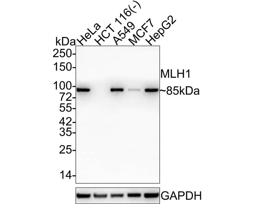 Western blot analysis on different lysates with NBP2-67381 at 1/5,000 dilution. Lane 1: HeLa cell lysate Lane 2: HCT 116 cell lysate (negative) Lane 3: A549 cell lysate Lane 4: MCF7 cell lysate Lane 5: HepG2 cell lysate Lysates/proteins at 20 µg/Lane. Predicted band size: 85 kDa Observed band size: 85 kDa Exposure time: 3 minutes; 4-20% SDS-PAGE gel. Proteins were transferred to a PVDF membrane and blocked with 5% NFDM/TBST for 1 hour at room temperature. NBP2-67381 at 1/5,000 dilution was used in 5% NFDM/TBST at 4℃ overnight. Goat Anti-Rabbit IgG [HRP] Secondary Antibody at 1:100,000 dilution was used for 1 hour at room temperature.