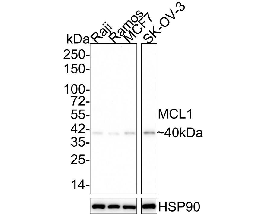 Western blot analysis on different lysates with NBP2-67400 at 1/2,000 dilution. Lane 1: Raji cell lysate Lane 2: Ramos cell lysate Lane 3: MCF7 cell lysate Lane 4: SK-OV-3 cell lysate Lysates/proteins at 15 µg/Lane. Predicted band size: 37 kDa Observed band size: 40 kDa Exposure time: 5 minutes 10 seconds; 4-20% SDS-PAGE gel. Proteins were transferred to a PVDF membrane and blocked with 5% NFDM/TBST for 1 hour at room temperature. NBP2-67400 at 1/2,000 dilution was used in 5% NFDM/TBST at 4℃ overnight. Goat Anti-Rabbit IgG [HRP] Secondary Antibody at 1/50,000 dilution was used for 1 hour at room temperature.