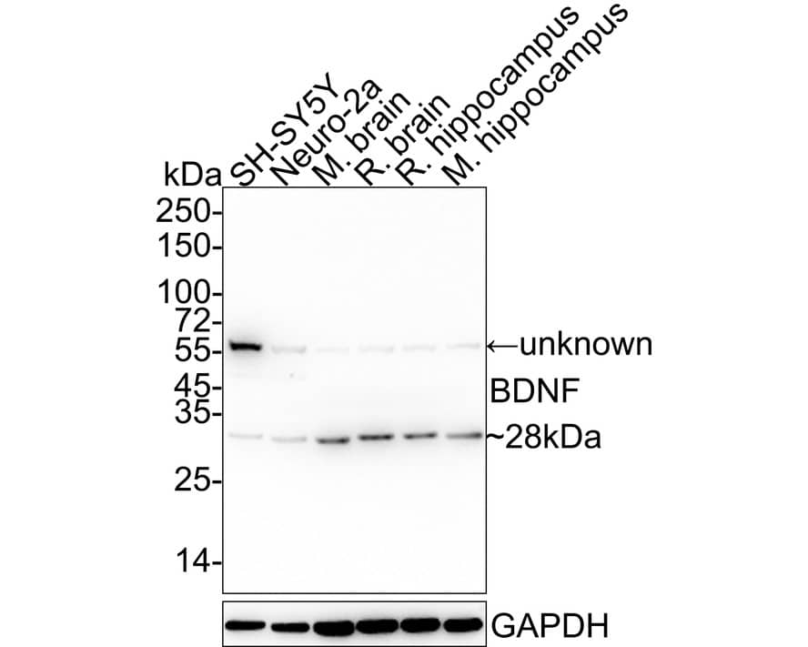 Western blot analysis on different lysates with NBP2-67410 at 1/5,000 dilution. Lane 1: SH-SY5Y cell lysate Lane 2: Neuro-2a cell lysate Lane 3: Mouse brain tissue lysate Lane 4: Rat brain tissue lysate Lane 5: Rat hippocampus tissue lysate Lane 6: Mouse hippocampus tissue lysate Lysates/proteins at 10 µg/Lane. Predicted band size: 28 kDa Observed band size: 28 kDa Exposure time: 1 minute 40 seconds; 4-20% SDS-PAGE gel. Proteins were transferred to a PVDF membrane and blocked with 5% NFDM/TBST for 1 hour at room temperature. NBP2-67410 at 1/5,000 dilution was used in 5% NFDM/TBST at 4℃ overnight. Goat Anti-Rabbit IgG [HRP] Secondary Antibody at 1/50,000 dilution was used for 1 hour at room temperature.