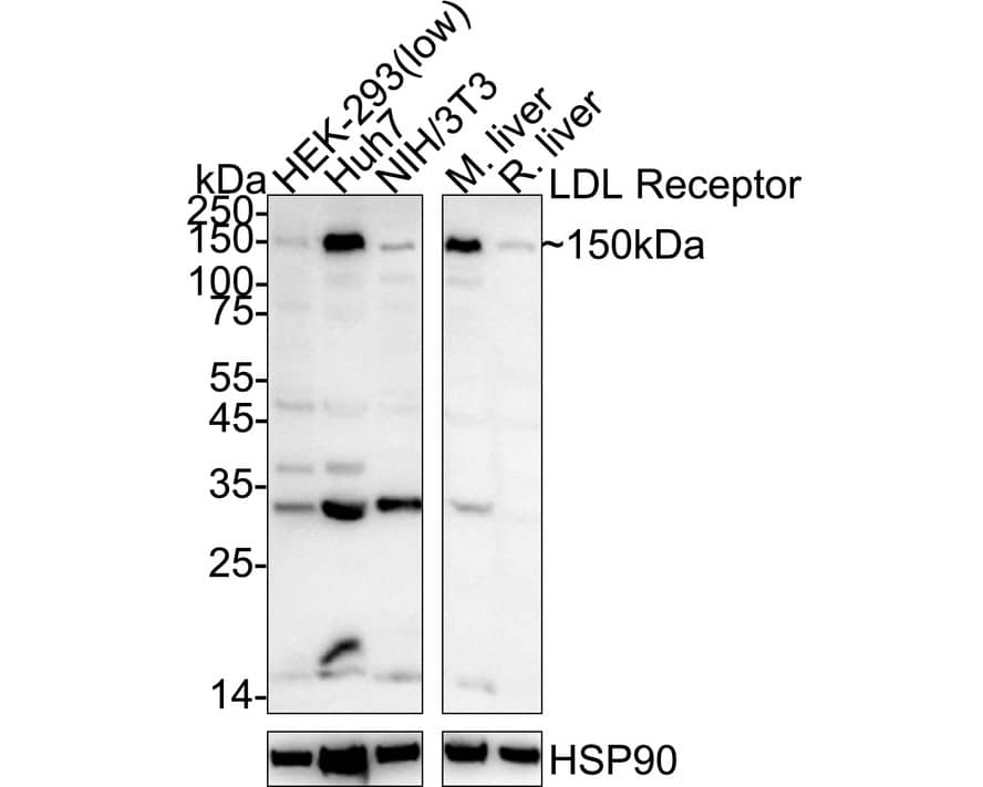 Western blot analysis on different lysates with NBP2-67414 at 1/5,000 dilution. Lane 1: HEK-293 cell lysate (low expression) (20 µg/Lane) Lane 2: Huh7 cell lysate (20 µg/Lane) Lane 3: NIH/3T3 cell lysate (20 µg/Lane) Lane 4: Mouse liver tissue lysate (30 µg/Lane) Lane 5: Rat liver tissue lysate (30 µg/Lane) Predicted band size: 95 kDa Observed band size: 150 kDa Exposure time: 3 minutes;  4-20% SDS-PAGE gel. Proteins were transferred to a PVDF membrane and blocked with 5% NFDM/TBST for 1 hour at room temperature. NBP2-67414 at 1/5,000 dilution was used in primary antibody dilution at 4℃ overnight. Goat Anti-Rabbit IgG [HRP] Secondary Antibody at 1/50,000 dilution was used for 1 hour at room temperature.