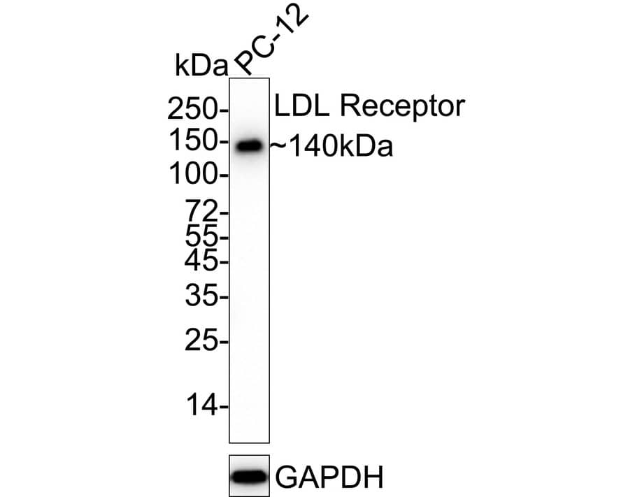 Western blot analysis of  PC-12 cell lysates with NBP2-67414 at 1/1,000 dilution. Lysates/proteins at 20 µg/Lane. Predicted band size: 95 kDa Observed band size: 140 kDa Exposure time: 6 seconds;  4-20% SDS-PAGE gel. Proteins were transferred to a PVDF membrane and blocked with 5% NFDM/TBST for 1 hour at room temperature. NBP2-67414 at 1/1,000 dilution was used in 5% NFDM/TBST at 4℃ overnight. Goat Anti-Rabbit IgG [HRP] Secondary Antibody at 1/50,000 dilution was used for 1 hour at room temperature.
