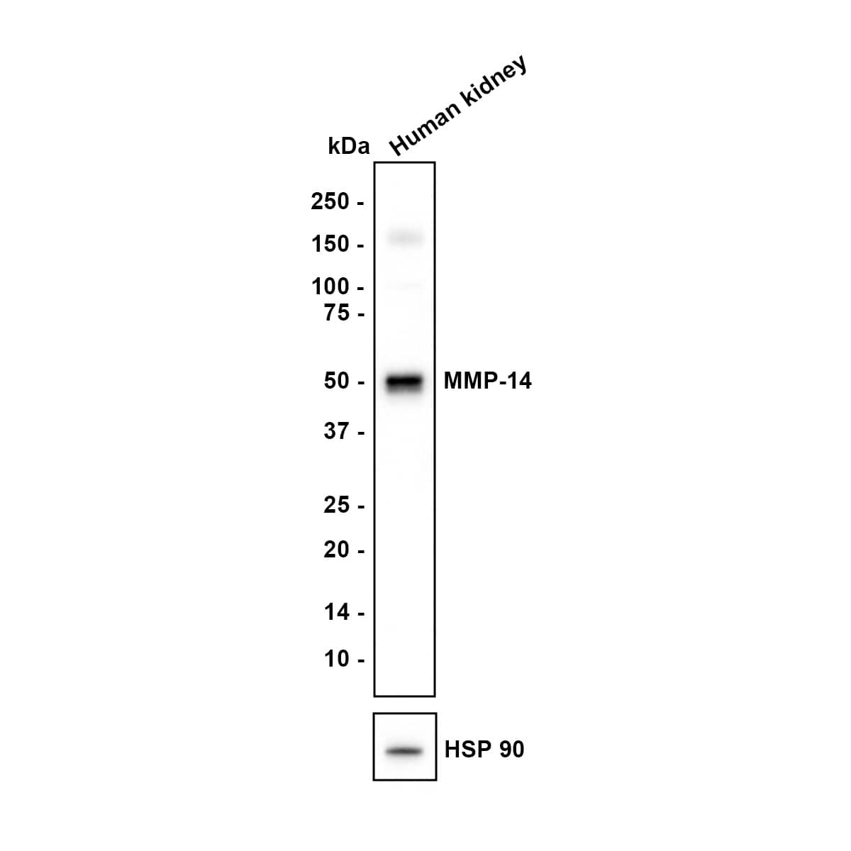 Western blot analysis on different lysates with NBP2-67415 at 1/1,000 dilution. Lane 1: human kidney Lysates/proteins at 20 µg/Lane. Exposure time: 30 seconds Blocking: 5% NFDM/TBST, 1 hour at room temperature Primary antibody: NBP2-67415, 1/1,000 in primary antibody dilution buffer, overnight at 4 ℃ Secondary antibody: Goat Anti-Rabbit IgG [HRP] Secondary Antibody, 1/50,000 in 5% NFDM/TBST, 1 hour at room temperature Predicted band size: 66 kDa Observed band size: 55 kDa