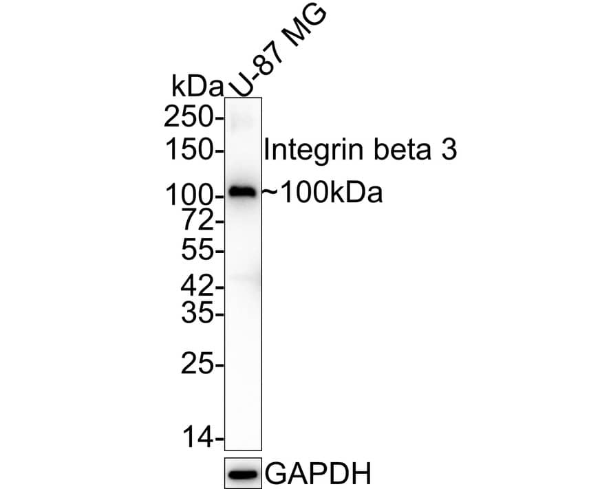Western blot analysis of  U-87 MG cell lysates with NBP2-67416 at 1/2,000 dilution. Lysates/proteins at 15 µg/Lane. Predicted band size: 87 kDa Observed band size: 100 kDa Exposure time: 1 minute 40 seconds; 4-20% SDS-PAGE gel. Proteins were transferred to a PVDF membrane and blocked with 5% NFDM/TBST for 1 hour at room temperature. NBP2-67416 at 1/2,000 dilution was used in 5% NFDM/TBST at 4℃ overnight. Goat Anti-Rabbit IgG [HRP] Secondary Antibody at 1:100,000 dilution was used for 1 hour at room temperature.