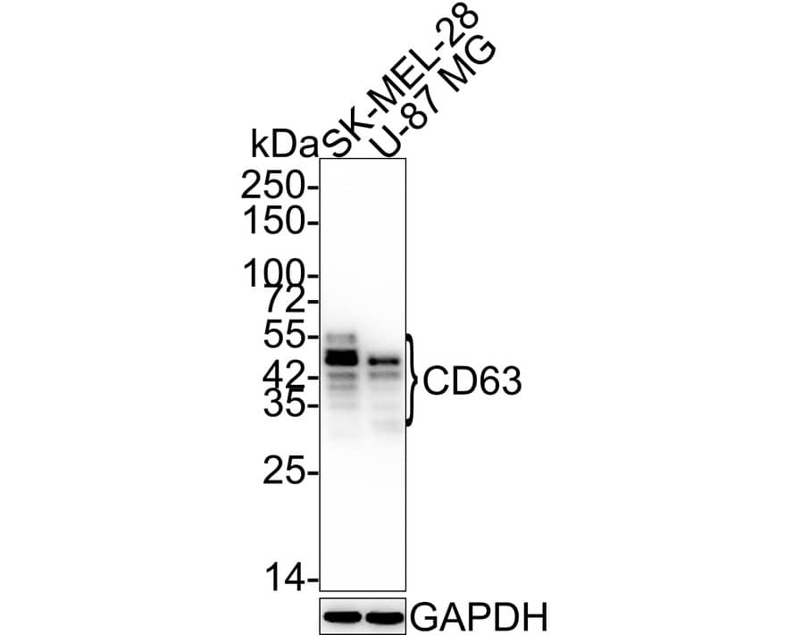 Western blot analysis on different lysates with NBP2-67425 at 1/2,000 dilution. Lane 1: SK-MEL-28 cell lysate Lane 2: U-87 MG cell lysate Lysates/proteins at 15 µg/Lane. Predicted band size: 26 kDa Observed band size: 30~60 kDa Exposure time: 43 seconds; 4-20% SDS-PAGE gel. Proteins were transferred to a PVDF membrane and blocked with 5% NFDM/TBST for 1 hour at room temperature. NBP2-67425 at 1/2,000 dilution was used in 5% NFDM/TBST at 4℃ overnight. Goat Anti-Rabbit IgG [HRP] Secondary Antibody at 1:50,000 dilution was used for 1 hour at room temperature.