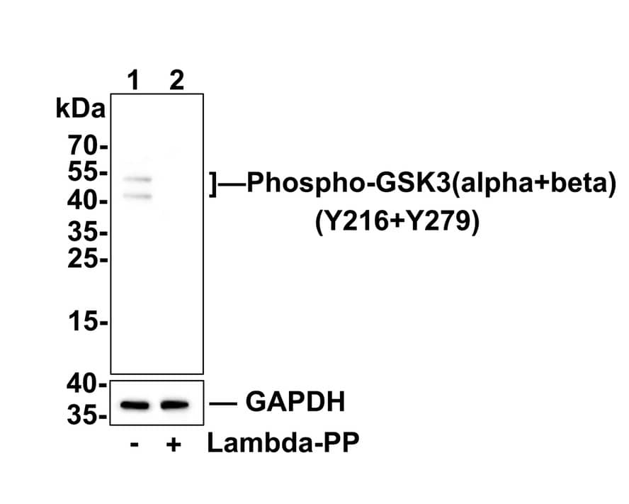 Western blot analysis of Phospho-GSK3(alpha+beta)(Y216+Y279) on mouse cerebellum tissue lysates. Lane 1: mouse cerebellum tissue, whole cell lysate, 20ug/lane Lane 2: mouse cerebellum tissue treated with 2.8ug/ul lambda-PP for 30 minutes, whole cell lysates, 20ug/lane All lanes : Anti-Phospho-GSK3(alpha+beta)(Y216+Y279) antibody (NBP2-67441) at 1:500 dilution. Anti-GAPDH antibody at 1:10,000 dilution. Goat Anti-Rabbit IgG [HRP] Secondary Antibody at 1/200,000 dilution. Predicted band size: 47/51 kDa Observed band size: 47/51 kDa Blocking and diluting buffer: 5% BSA. Exposure time: 2 minutes