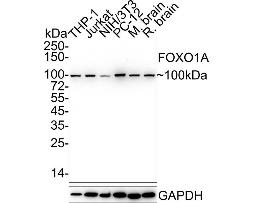 Western blot analysis on different lysates with NBP2-67463 at 1/5,000 dilution. Lane 1: THP-1 cell lysate (15 µg/Lane) Lane 2: Jurkat cell lysate (15 µg/Lane) Lane 3: NIH/3T3 cell lysate (15 µg/Lane) Lane 4: PC-12 cell lysate (15 µg/Lane) Lane 5: Mouse brain tissue lysate (20 µg/Lane) Lane 6: Rat brain tissue lysate (20 µg/Lane) Predicted band size: 70 kDa Observed band size: 100 kDa Exposure time: 3 minutes; 4-20% SDS-PAGE gel. Proteins were transferred to a PVDF membrane and blocked with 5% NFDM/TBST for 1 hour at room temperature. NBP2-67463 at 1/5,000 dilution was used in 5% NFDM/TBST at 4℃ overnight. Goat Anti-Rabbit IgG [HRP] Secondary Antibody at 1/50,000 dilution was used for 1 hour at room temperature.