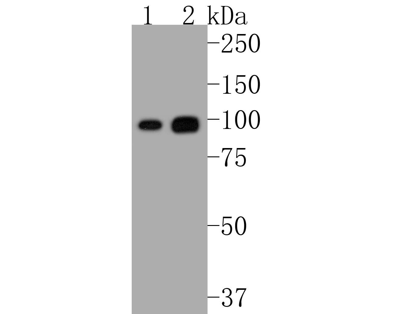 Western blot analysis on different lysates with NBP2-67465 at 1/2,000 dilution. Lane 1: HepG2 cell lysate Lane 2: Raji cell lysate Lysates/proteins at 10 µg/Lane. Predicted band size: 68 kDa Observed band size: 100 kDa Exposure time: 30 seconds; 8% SDS-PAGE gel. Proteins were transferred to a PVDF membrane and blocked with 5% NFDM/TBST for 1 hour at room temperature. NBP2-67465 at 1/2,000 dilution was used in 5% NFDM/TBST at room temperature for 2 hours. Goat Anti-Rabbit IgG [HRP] Secondary Antibody at 1/50,000 dilution was used for 1 hour at room temperature.