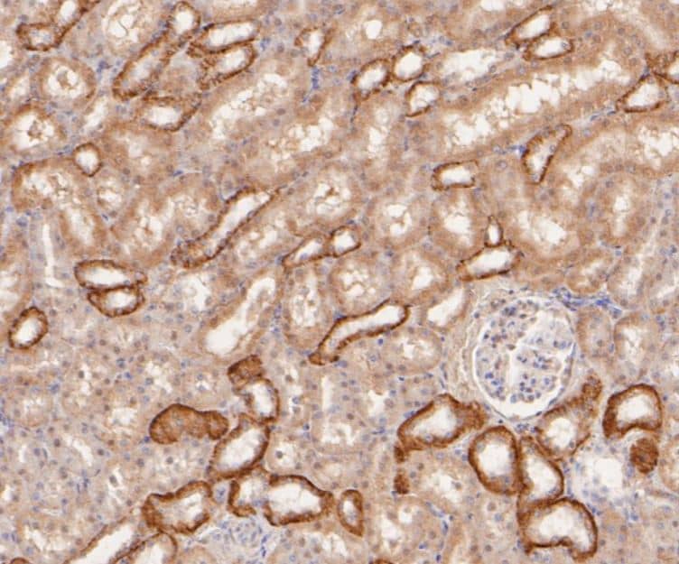 Immunohistochemistry-Paraffin: Nrf2 [p Ser40] Antibody (SU0334) [NBP2-67465] -Rat kidney tissue using anti-RIP3 antibody. The section was pre-treated using heat mediated antigen retrieval with Tris-EDTA buffer (pH 8.0-8.4) for 20 minutes.The tissues were blocked in 5% BSA for 30 minutes at room temperature, washed with ddH2O and PBS, and then probed with the primary antibody (1/50) for 30 minutes at room temperature. The detection was performed using an HRP conjugated compact polymer system. DAB was used as the chromogen. Tissues were counterstained with hematoxylin and mounted with DPX.