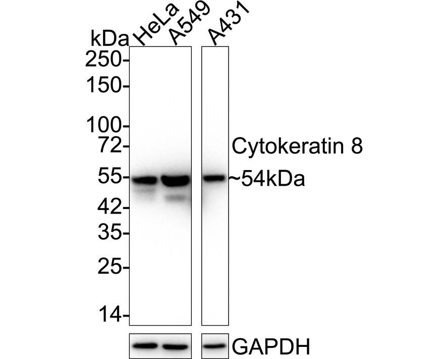 Western blot analysis on different lysates with NBP2-67468 at 1/2,000 dilution. Lane 1: HeLa cell lysate Lane 2: A549 cell lysate Lane 3: A431 cell lysate Lysates/proteins at 20 µg/Lane. Predicted band size: 54 kDa Observed band size: 54 kDa Exposure time: 24 seconds;  4-20% SDS-PAGE gel. Proteins were transferred to a PVDF membrane and blocked with 5% NFDM/TBST for 1 hour at room temperature. NBP2-67468 at 1/2,000 dilution was used in 5% NFDM/TBST at 4℃ overnight. Goat Anti-Rabbit IgG [HRP] Secondary Antibody at 1/50,000 dilution was used for 1 hour at room temperature.