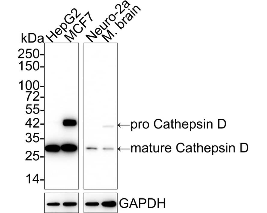 Western blot analysis on different lysates with NBP2-67477 at 1/2,000 dilution. Lane 1: HepG2 cell lysate (15 µg/Lane) Lane 2: MCF7 cell lysate (15 µg/Lane) Lane 3: Neuro-2a cell lysate (15 µg/Lane) Lane 4: Mouse brain tissue lysate (20 µg/Lane) Predicted band size: 45/28 kDa Observed band size: 45/28 kDa Exposure time: 3 minutes;  4-20% SDS-PAGE gel. Proteins were transferred to a PVDF membrane and blocked with 5% NFDM/TBST for 1 hour at room temperature. NBP2-67477 at 1/2,000 dilution was used in 5% NFDM/TBST at 4℃ overnight. Goat Anti-Rabbit IgG [HRP] Secondary Antibody at 1/50,000 dilution was used for 1 hour at room temperature.