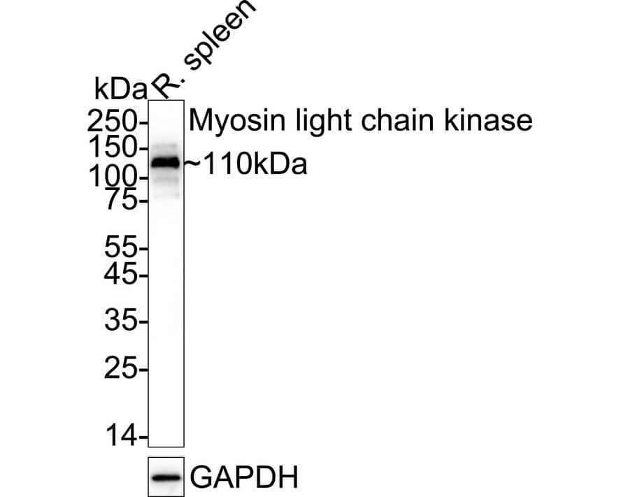 Western blot analysis of  rat spleen tissue lysates with NBP2-67486 at 1/1,000 dilution. Lysates/proteins at 20 µg/Lane. Predicted band size: 211 kDa Observed band size: 110 kDa Exposure time: 20 seconds;  4-20% SDS-PAGE gel. Proteins were transferred to a PVDF membrane and blocked with 5% NFDM/TBST for 1 hour at room temperature. NBP2-67486 at 1/1,000 dilution was used in 5% NFDM/TBST at 4℃ overnight. Goat Anti-Rabbit IgG [HRP] Secondary Antibody at 1/50,000 dilution was used for 1 hour at room temperature.