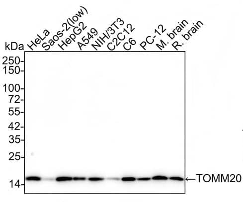 Western Blot TOMM20 Antibody (ST04-72)