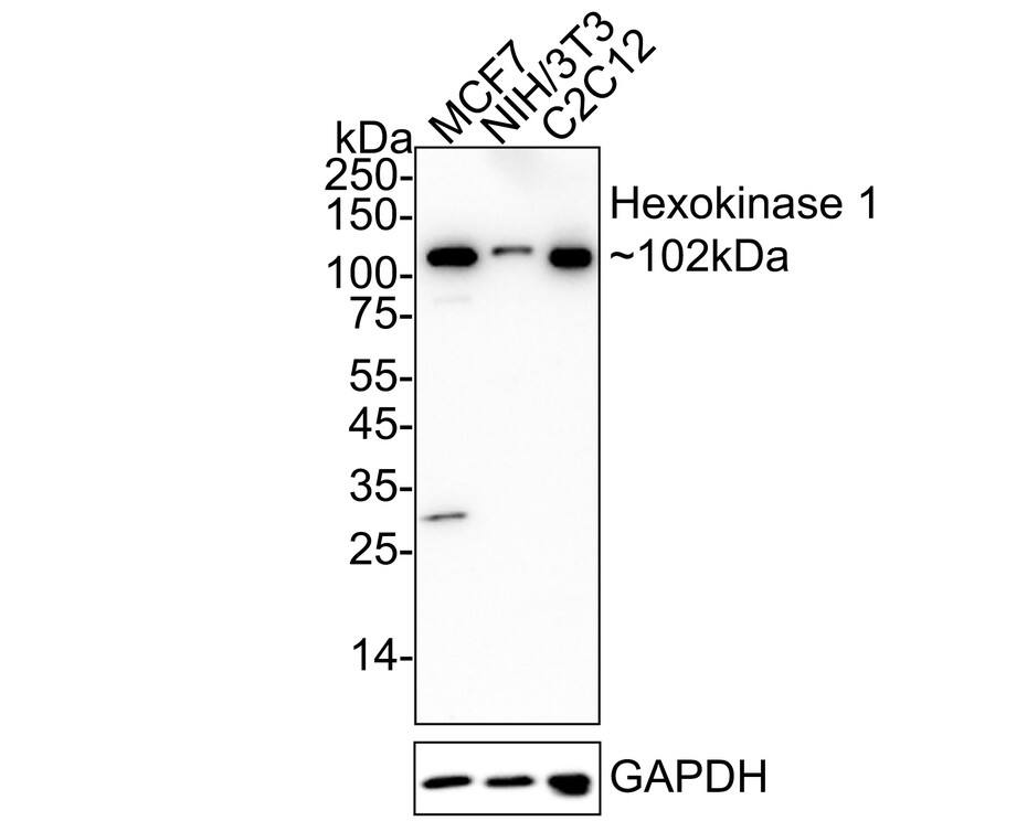 Western Blot Hexokinase 1 Antibody (ST47-05)
