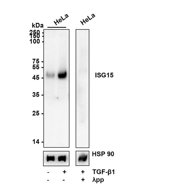 Western blot analysis of  HeLa lysates with NBP2-67513 at 1/2,000 dilution. Lane 1: HeLa cell lysate Lane 2: HeLa treated with 10 ng/ml TGF beta1 for 30 minutes cell lysate Lane 3: HeLa treated with 10 ng/ml TGF beta1 for 30 minutes cell lysate，then the membrane treated with  lambda pp for 1 hour Lysates/proteins at 20 µg/Lane. Exposure time: 2 minutes Blocking: 5% NFDM/TBST, 1 hour at room temperature Primary antibody: NBP2-67513, 1/2,000 in primary antibody dilution buffer, overnight at 4 ℃ Secondary antibody: Goat Anti-Rabbit IgG [HRP] Secondary Antibody, 1/50,000 in 5% NFDM/TBST, 1 hour at room temperature Predicted band size: 48 kDa Observed band size: 48 kDa