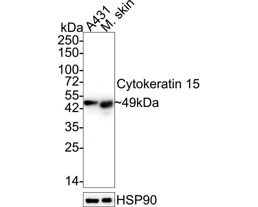 Western blot analysis on different lysates with NBP2-67525 at 1/1,000 dilution. Lane 1: A431 cell lysate (20 µg/Lane) Lane 2: Mouse skin tissue lysate (40 µg/Lane) Predicted band size: 49 kDa Observed band size: 49 kDa Exposure time: 25 seconds;  4-20% SDS-PAGE gel. Proteins were transferred to a PVDF membrane and blocked with 5% NFDM/TBST for 1 hour at room temperature. NBP2-67525 at 1/1,000 dilution was used in 5% NFDM/TBST at 4℃ overnight. Goat Anti-Rabbit IgG [HRP] Secondary Antibody at 1/50,000 dilution was used for 1 hour at room temperature.