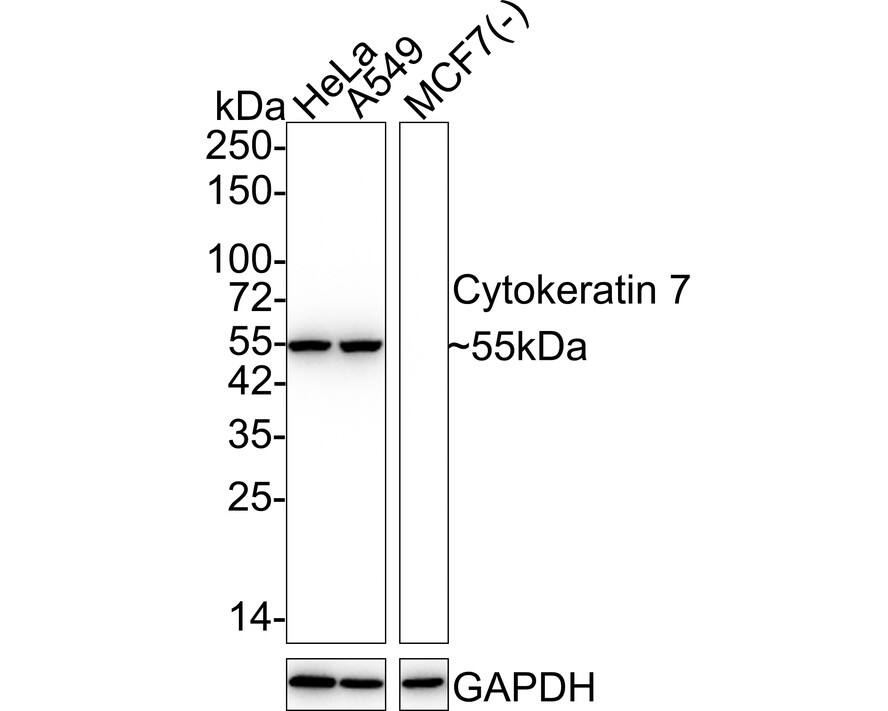 Western blot analysis on different lysates with NBP2-67533 at 1/5,000 dilution. Lane 1: HeLa cell lysate Lane 2: A549 cell lysate Lane 3: MCF7 cell lysate (negative) Lysates/proteins at 15 µg/Lane. Predicted band size: 51 kDa Observed band size: 55 kDa Exposure time: 20 seconds; 4-20% SDS-PAGE gel. Proteins were transferred to a PVDF membrane and blocked with 5% NFDM/TBST for 1 hour at room temperature. NBP2-67533 at 1/5,000 dilution was used in 5% NFDM/TBST at 4℃ overnight. Goat Anti-Rabbit IgG [HRP] Secondary Antibody at 1/50,000 dilution was used for 1 hour at room temperature.