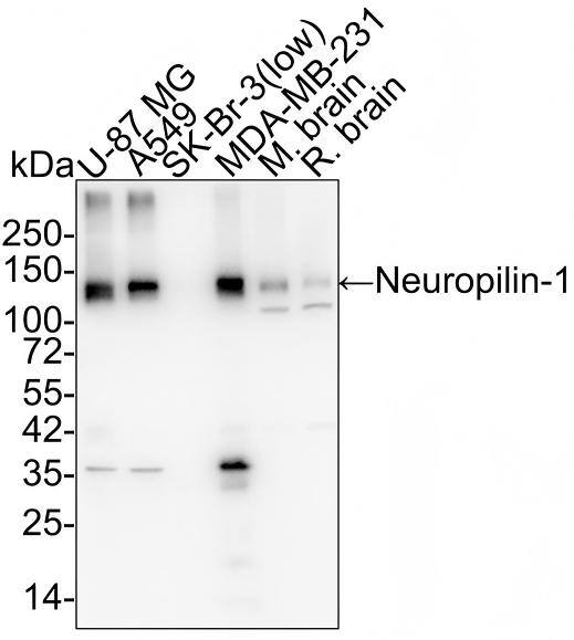 Western blot analysis on different lysates with NBP2-67539 at 1/2,000 dilution and competitor's antibody at 1/2,000 dilution. Lane 1: U-87 MG cell lysate Lane 2: A549 cell lysate Lane 3: SK-Br-3 cell lysate (low expression) Lane 4: MDA-MB-231 cell lysate Lane 5: Mouse brain tissue lysate Lane 6: Rat brain tissue lysate Lysates/proteins at 20 µg/Lane. Predicted band size: 103 kDa Observed band size: 130 kDa Exposure time: 35 seconds; 4-20% SDS-PAGE gel. Proteins were transferred to a PVDF membrane and blocked with 5% NFDM/TBST for 1 hour at room temperature. NBP2-67539 at 1/2,000 dilution and competitor's antibody at 1/2,000 dilution were used in 5% BSA at 4℃ overnight. Goat Anti-Rabbit IgG [HRP] Secondary Antibody at 1/50,000 dilution was used for 1 hour at room temperature.