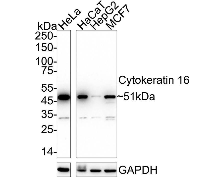Western blot analysis on different lysates with NBP2-67559 at 1/1,000 dilution. Lane 1: HeLa cell lysate Lane 2: HaCaT cell lysate Lane 3: HepG2 cell lysate Lane 4: MCF7 cell lysate Lysates/proteins at 20 µg/Lane. Predicted band size: 51 kDa Observed band size: 51 kDa Exposure time: 16 seconds;  4-20% SDS-PAGE gel. Proteins were transferred to a PVDF membrane and blocked with 5% NFDM/TBST for 1 hour at room temperature. NBP2-67559 at 1/1,000 dilution was used in 5% NFDM/TBST at 4℃ overnight. Goat Anti-Rabbit IgG [HRP] Secondary Antibody at 1/50,000 dilution was used for 1 hour at room temperature.