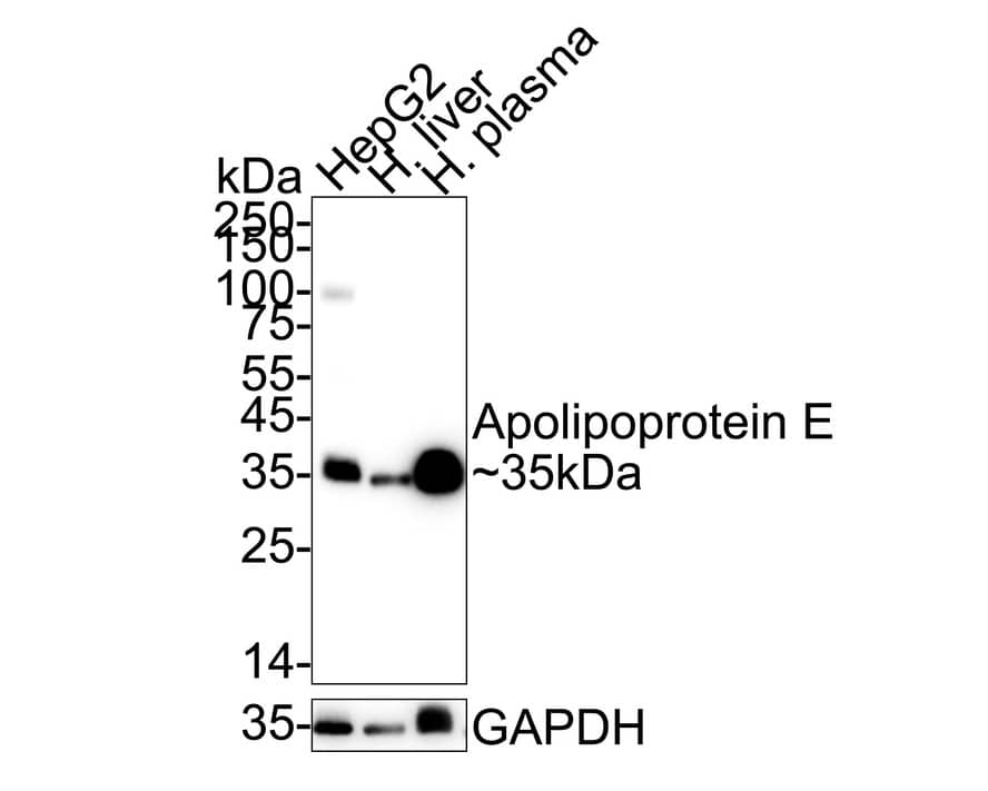 Western blot analysis on different lysates with NBP2-67565 at 1/2,000 dilution. Lane 1: HepG2 cell lysate Lane 2: Human liver tissue lysate Lane 3: Human plasma tissue lysate Lysates/proteins at 20 µg/Lane1 and 40ug/Lane2-3. Predicted band size: 35 kDa Observed band size: 35 kDa Exposure time: 20 seconds;  4-20% SDS-PAGE gel. Proteins were transferred to a PVDF membrane and blocked with 5% NFDM/TBST for 1 hour at room temperature. NBP2-67565 at 1/2,000 dilution was used in 5% NFDM/TBST at 4℃ overnight. Goat Anti-Rabbit IgG [HRP] Secondary Antibody at 1/50,000 dilution was used for 1 hour at room temperature.