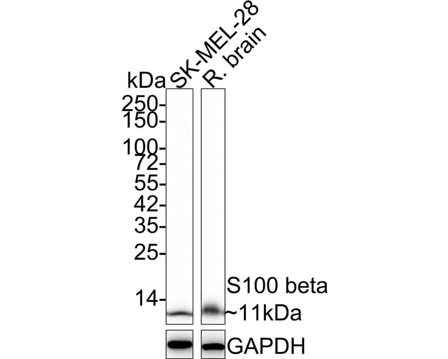 Western blot analysis on different lysates with NBP2-67572 at 1/2,000 dilution. Lane 1: SK-MEL-28 cell lysate (15 µg/Lane) Lane 2: Rat brain tissue lysate (20 µg/Lane) Predicted band size: 11 kDa Observed band size: 11 kDa Exposure time: 3 minutes 10 seconds;  4-20% SDS-PAGE gel. Proteins were transferred to a PVDF membrane and blocked with 5% NFDM/TBST for 1 hour at room temperature. NBP2-67572 at 1/2,000 dilution was used in 5% NFDM/TBST at 4℃ overnight. Goat Anti-Rabbit IgG [HRP] Secondary Antibody at 1:50,000 dilution was used for 1 hour at room temperature.