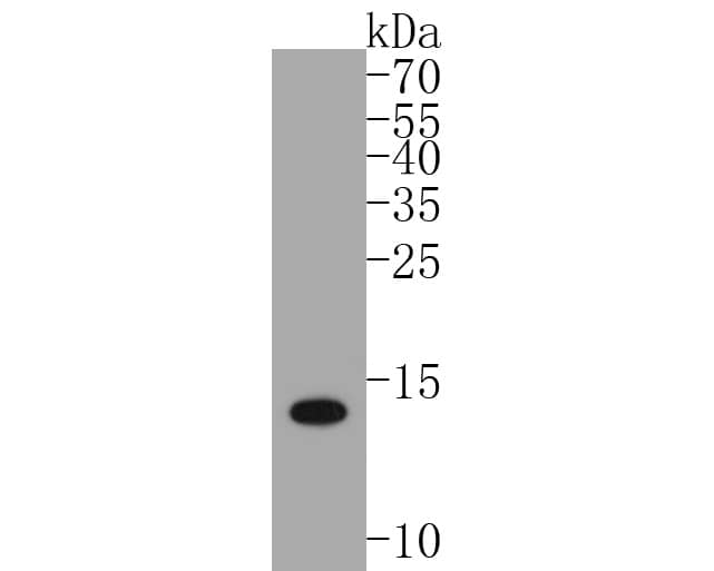 Western blot analysis of S100 beta on zebrafish tissue lysates. Proteins were transferred to a PVDF membrane and blocked with 5% BSA in PBS for 1 hour at room temperature. The primary antibody (NBP2-67572, 1/500) was used in 5% BSA at room temperature for 2 hours. Goat Anti-Rabbit IgG [HRP] Secondary Antibody at 1:5,000 dilution was used for 1 hour at room temperature. Predicted band size: 11 kDa Observed band size: 14 kDa