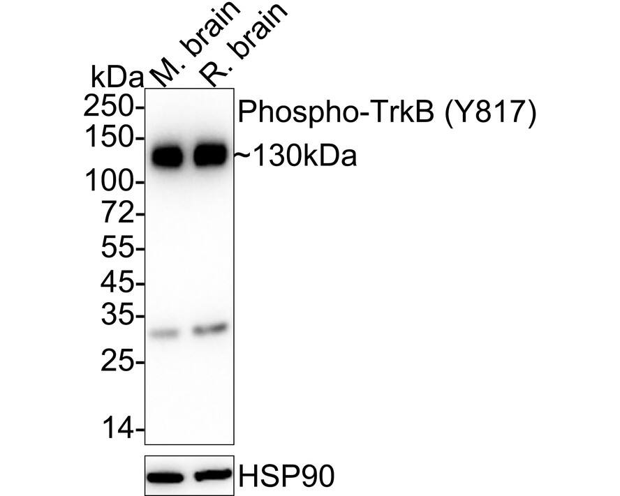 Western blot analysis on different lysates with NBP2-67578 at 1/2,000 dilution. Lane 1: Mouse brain tissue lysate Lane 2: Rat brain tissue lysate Lysates/proteins at 20 µg/Lane. Predicted band size: 92 kDa Observed band size: 130 kDa Exposure time: 1 minute;  4-20% SDS-PAGE gel. Proteins were transferred to a PVDF membrane and blocked with 5% NFDM/TBST for 1 hour at room temperature. NBP2-67578 at 1/2,000 dilution was used in 5% NFDM/TBST at 4℃ overnight. Goat Anti-Rabbit IgG [HRP] Secondary Antibody at 1/50,000 dilution was used for 1 hour at room temperature.