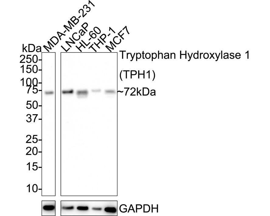 Western blot analysis on different lysates with NBP2-67580 at 1/1,000 dilution. Lane 1: MDA-MB-231 cell lysate Lane 2: LNCaP cell lysate Lane 3: HL-60 cell lysate Lane 4: THP-1 cell lysate Lane 5: MCF7 cell lysate Lysates/proteins at 20 µg/Lane. Predicted band size: 51 kDa Observed band size: 72 kDa Exposure time: 3 minutes; 4-20% SDS-PAGE gel. Proteins were transferred to a PVDF membrane and blocked with 5% NFDM/TBST for 1 hour at room temperature. NBP2-67580 at 1/1,000 dilution was used in 5% NFDM/TBST at 4℃ overnight. Goat Anti-Rabbit IgG [HRP] Secondary Antibody at 1/50,000 dilution was used for 1 hour at room temperature.