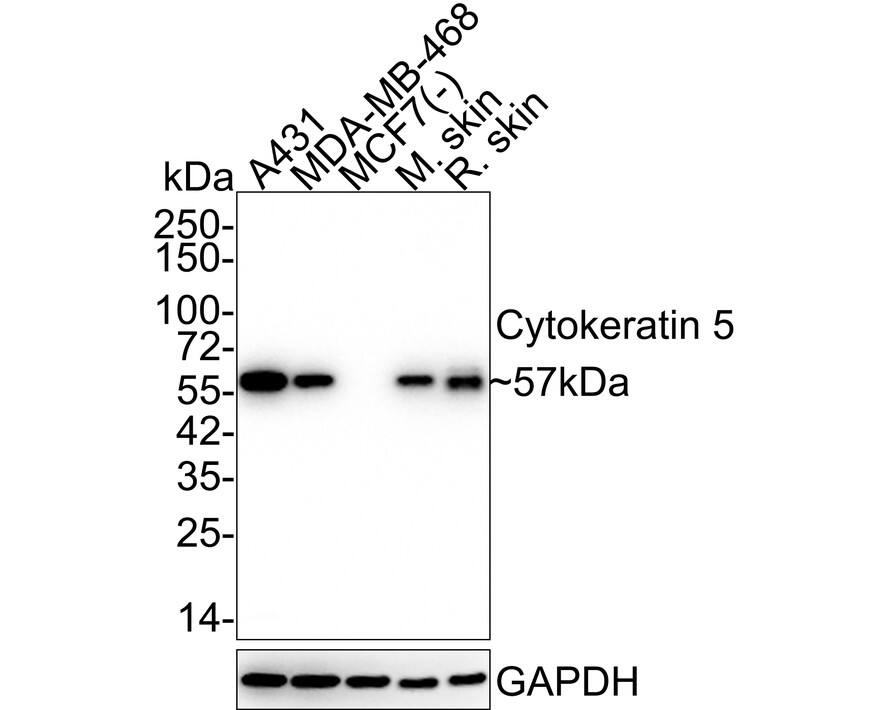 Western blot analysis on different lysates with NBP2-67586 at 1/5,000 dilution. Lane 1: A431 cell lysate Lane 2: MDA-MB-468 cell lysate Lane 3: MCF7 cell lysate (negative) Lane 4: Mouse skin tissue lysate Lane 5: Rat skin tissue lysate Lysates/proteins at 20 µg/Lane. Predicted band size: 62 kDa Observed band size: 57 kDa Exposure time: 2 minutes 6 seconds; 4-20% SDS-PAGE gel. Proteins were transferred to a PVDF membrane and blocked with 5% NFDM/TBST for 1 hour at room temperature. NBP2-67586 at 1/5,000 dilution was used in 5% NFDM/TBST at 4℃ overnight. Goat Anti-Rabbit IgG [HRP] Secondary Antibody at 1/50,000 dilution was used for 1 hour at room temperature.