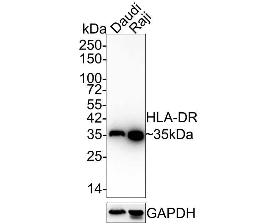 Western blot analysis on different lysates with NBP2-67610 at 1/1,000 dilution. Lane 1: Daudi cell lysate Lane 2: Raji cell lysate Lysates/proteins at 20 µg/Lane. Predicted band size: 29 kDa Observed band size: 35 kDa Exposure time: 1 minute 40 seconds; 4-20% SDS-PAGE gel. Proteins were transferred to a PVDF membrane and blocked with 5% NFDM/TBST for 1 hour at room temperature. NBP2-67610 at 1/1,000 dilution was used in 5% NFDM/TBST at 4℃ overnight. Goat Anti-Rabbit IgG [HRP] Secondary Antibody at 1:100,000 dilution was used for 1 hour at room temperature.