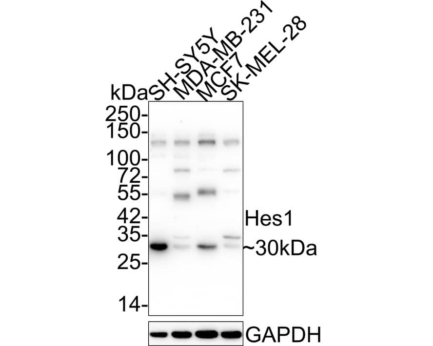 Western blot analysis on different lysates with NBP2-67642 at 1/5,000 dilution. Lane 1: SH-SY5Y cell lysate Lane 2: MDA-MB-231 cell lysate Lane 3: MCF7 cell lysate Lane 4: SK-MEL-28 cell lysate Lysates/proteins at 15 µg/Lane. Predicted band size: 30 kDa Observed band size: 30 kDa Exposure time: 1 minute 20 seconds; 4-20% SDS-PAGE gel. Proteins were transferred to a PVDF membrane and blocked with 5% NFDM/TBST for 1 hour at room temperature. NBP2-67642 at 1/5,000 dilution was used in 5% NFDM/TBST at 4℃ overnight. Goat Anti-Rabbit IgG [HRP] Secondary Antibody at 1:50,000 dilution was used for 1 hour at room temperature.
