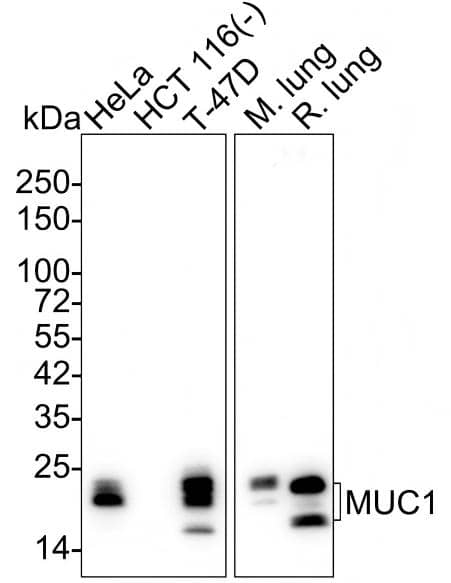 Western blot analysis on different lysates with NBP2-67650 at 1/2,000 dilution and competitor's antibody at 1/1,000 dilution. Lane 1: HeLa cell lysate (20 µg/Lane) Lane 2: HCT 116 cell lysate (negative) (20 µg/Lane) Lane 3: T-47D cell lysate (20 µg/Lane) Lane 4: Mouse lung tissue lysate (40 µg/Lane) Lane 5: Rat lung tissue lysate (40 µg/Lane) Predicted band size: 122 kDa Observed band size: 17~24 kDa Exposure time: 3 minutes 10 seconds;  4-20% SDS-PAGE gel. Proteins were transferred to a PVDF membrane and blocked with 5% NFDM/TBST for 1 hour at room temperature. NBP2-67650 at 1/2,000 dilution and competitor's antibody at 1/1,000 dilution were used in 5% NFDM/TBST at 4℃ overnight. Goat Anti-Rabbit IgG [HRP] Secondary Antibody at 1/50,000 dilution was used for 1 hour at room temperature.