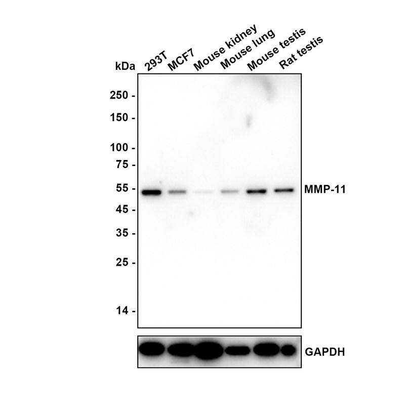 Western blot analysis on different lysates with NBP2-67670 at 1/2,000 dilution. Lane 1: 293T cell lysate (15 µg/Lane) Lane 2: MCF7 cell lysate (15 µg/Lane) Lane 3: Mouse kidney tissue lysate (20 µg/Lane) Lane 4: Mouse lung tissue lysate (20 µg/Lane) Lane 5: Mouse testis tissue lysate (20 µg/Lane) Lane 6: Rat testis tissue lysate (20 µg/Lane) Predicted band size: 55 kDa Observed band size: 55 kDa Exposure time: 3 minutes; 4-20% SDS-PAGE gel. Proteins were transferred to a PVDF membrane and blocked with 5% NFDM/TBST for 1 hour at room temperature. NBP2-67670 at 1/2,000 dilution was used in 5% NFDM/TBST at 4℃ overnight. Goat Anti-Rabbit IgG [HRP] Secondary Antibody at 1/50,000 dilution was used for 1 hour at room temperature.