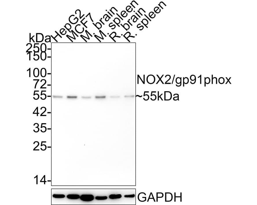 Western blot analysis on different lysates with NBP2-67680 at 1/2,000 dilution. Lane 1: HepG2 cell lysate (15 µg/Lane) Lane 2: MCF7 cell lysate (15 µg/Lane) Lane 3: Mouse brain tissue lysate (20 µg/Lane) Lane 4: Mouse spleen tissue lysate (20 µg/Lane) Lane 5: Rat brain tissue lysate (20 µg/Lane) Lane 6: Rat spleen tissue lysate (20 µg/Lane) Predicted band size: 65 kDa Observed band size: 55 kDa Exposure time: 3 minutes; 4-20% SDS-PAGE gel. Proteins were transferred to a PVDF membrane and blocked with 5% NFDM/TBST for 1 hour at room temperature. NBP2-67680 at 1/2,000 dilution was used in 5% NFDM/TBST at 4℃ overnight. Goat Anti-Rabbit IgG [HRP] Secondary Antibody at 1/50,000 dilution was used for 1 hour at room temperature.