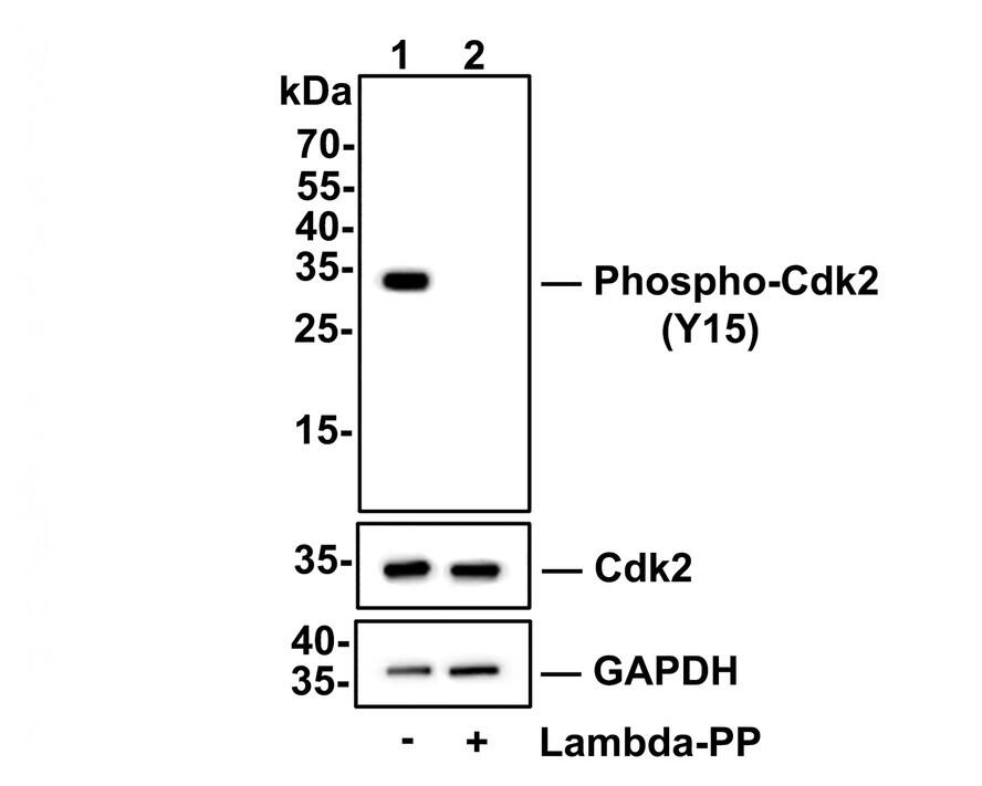 Western blot analysis of Hela cell lysates. Lane 1: Hela cells, whole cell lysate, 10ug/lane Lane 2: Hela cells treated with 2.8ug/ul lambda-PP for 30 minutes, whole cell lysates, 10ug/lane All lanes : Anti-Phospho-Cdk2(Y15) antibody (NBP2-67686) at 1/500 dilution. Anti-Cdk2 antibody at 1/500 dilution. Anti-GAPDH antibody at 1/10,000 dilution. Goat Anti-Rabbit IgG [HRP] Secondary Antibody at 1/200,000 dilution. Predicted band size: 34 kDa Observed band size: 34 kDa Blocking and diluting buffer: 5% BSA. Exposure time: 30 seconds