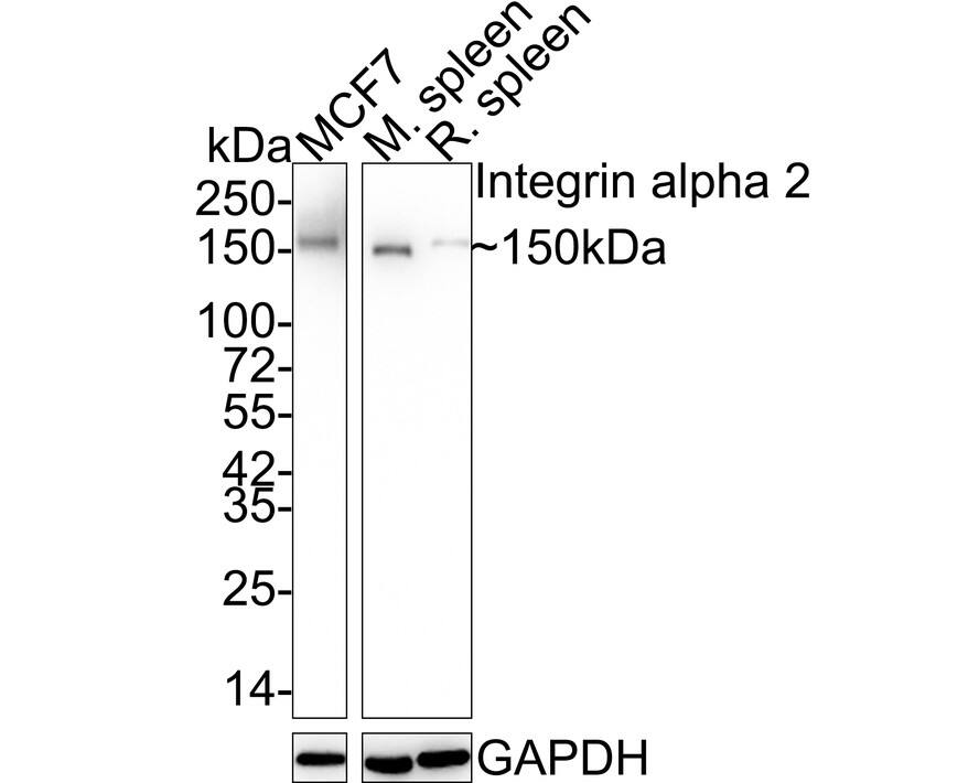 Western blot analysis on different lysates with NBP2-67691 at 1/5,000 dilution. Lane 1: MCF7 cell lysate Lane 2: Mouse spleen tissue lysate Lane 3: Rat spleen tissue lysate Lysates/proteins at 20 µg/Lane. Predicted band size: 129 kDa Observed band size: 150 kDa Exposure time: 24 seconds; 4-20% SDS-PAGE gel. Proteins were transferred to a PVDF membrane and blocked with 5% NFDM/TBST for 1 hour at room temperature. NBP2-67691 at 1/5,000 dilution was used in 5% NFDM/TBST at 4℃ overnight. Goat Anti-Rabbit IgG [HRP] Secondary Antibody at 1:50,000 dilution was used for 1 hour at room temperature.