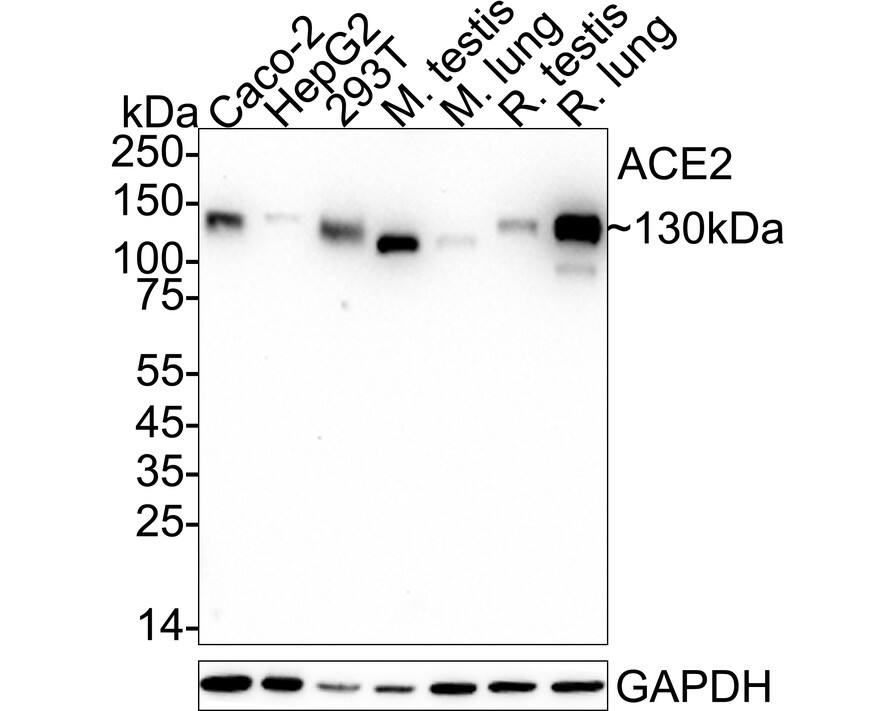 Western blot analysis on different lysates with NBP2-67692 at 1/2,000 dilution. Lane 1: Caco-2 cell lysate (20 µg/Lane) Lane 2: HepG2 cell lysate (20 µg/Lane) Lane 3: 293T cell lysate (20 µg/Lane) Lane 4: Mouse testis tissue lysate (40 µg/Lane) Lane 5: Mouse lung tissue lysate (40 µg/Lane) Lane 6: Rat testis tissue lysate (40 µg/Lane) Lane 7: Rat lung tissue lysate (40 µg/Lane) Predicted band size: 92 kDa Observed band size: 130 kDa Exposure time: 3 minutes;  4-20% SDS-PAGE gel. Proteins were transferred to a PVDF membrane and blocked with 5% NFDM/TBST for 1 hour at room temperature. NBP2-67692 at 1/2,000 dilution was used in 5% NFDM/TBST at 4℃ overnight. Goat Anti-Rabbit IgG [HRP] Secondary Antibody at 1/50,000 dilution was used for 1 hour at room temperature.